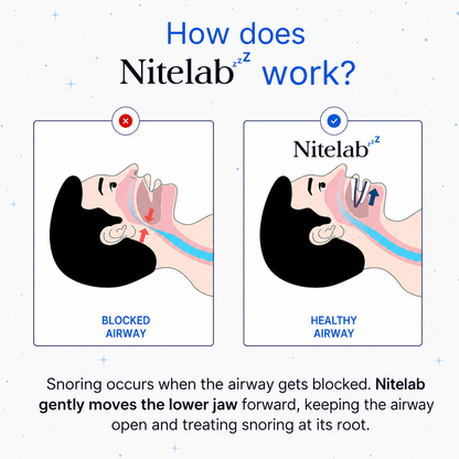Nitelab® Anti-Snoring Mouthpiece